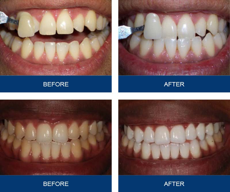 Before/after comparison